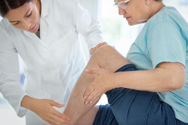 Varicose Veins vs. Spider Veins: Understanding the Differences and Treatment Options